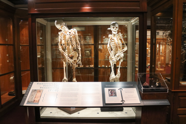Two skeletons next to each other in a display case